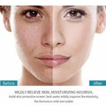 Face Care Hyaluronic Acid Serum Cosmetics Acne Essence Collagen Moisturizing Whitening Pore Shrinking Anti Aging Skincare Set