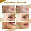Face Korean Nourish Moisturizer Centella Asiatica Face Serum Nourish Dry Skin Smoothing Rejuvenation Skin Brightening Whitening Cream Facial Moisturizer Korean