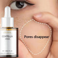 Face Korean Nourish Moisturizer Centella Asiatica Face Serum Nourish Dry Skin Smoothing Rejuvenation Skin Brightening Whitening Cream Facial Moisturizer Korean