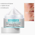 Whitening Freckles Cream Remove Melasma Dark Spots Lighten Melanin Melasma Remover Moisturizing Brighten Face Skin Care TRSTAY