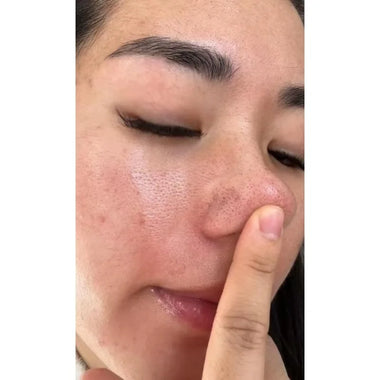 Acid Pore Shrinking Serum Repairing Tightening Face Serum Moisturizing Oil Control Skin Care Korean Cosmetic