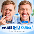 Full Mouth Dentures Set, Removable Upper and Lower False Teeth, Natural Looking Smile for Adults
