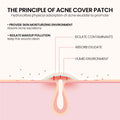 Acne Pimple Patch Hydrocolloid Spot Treatment for Face Invisible Zit Stickers 200pcs/box Star  Repair Acne Patch Face Skin Care