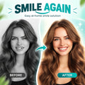 Full Mouth Dentures Set, Removable Upper and Lower False Teeth, Natural Looking Smile for Adults