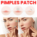Acne Pimple Patch Hydrocolloid Spot Treatment for Face Invisible Zit Stickers 200pcs/box Star  Repair Acne Patch Face Skin Care