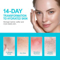 Hyaluronic Acid Face Serum & Cream Skin Care Set Deep Nourishing Lasting Moisturising Anti Dry Facial Skincare Cosmetics Kit