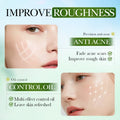 Salicylic Acid Acne Treatment Face Cream Repair Pimple Spots Deep Cleaning Pore Anti-acne Scar Oil Control Moisturizer Skin Care