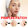 Acne Pimple Patch Hydrocolloid Spot Treatment for Face Invisible Zit Stickers 200pcs/box Star  Repair Acne Patch Face Skin Care